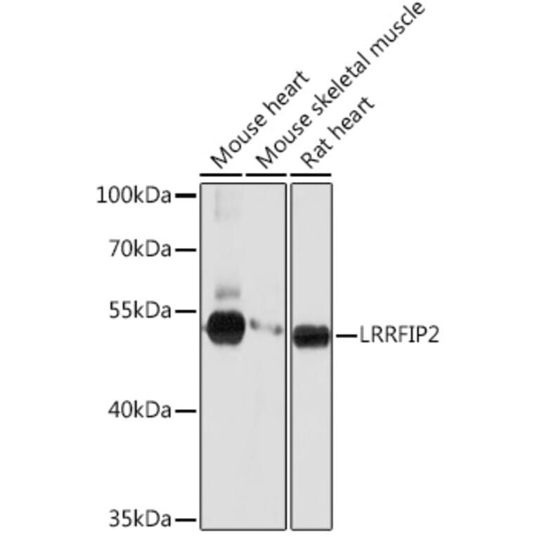Western Blot - Anti-LRRFIP2 Antibody (A93256) - Antibodies.com