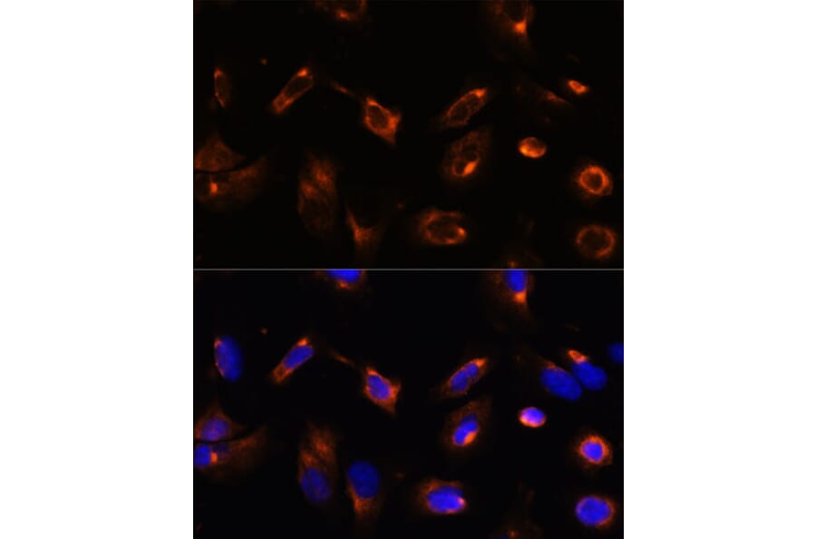 Immunofluorescence - Anti-LRRFIP2 Antibody (A93256) - Antibodies.com