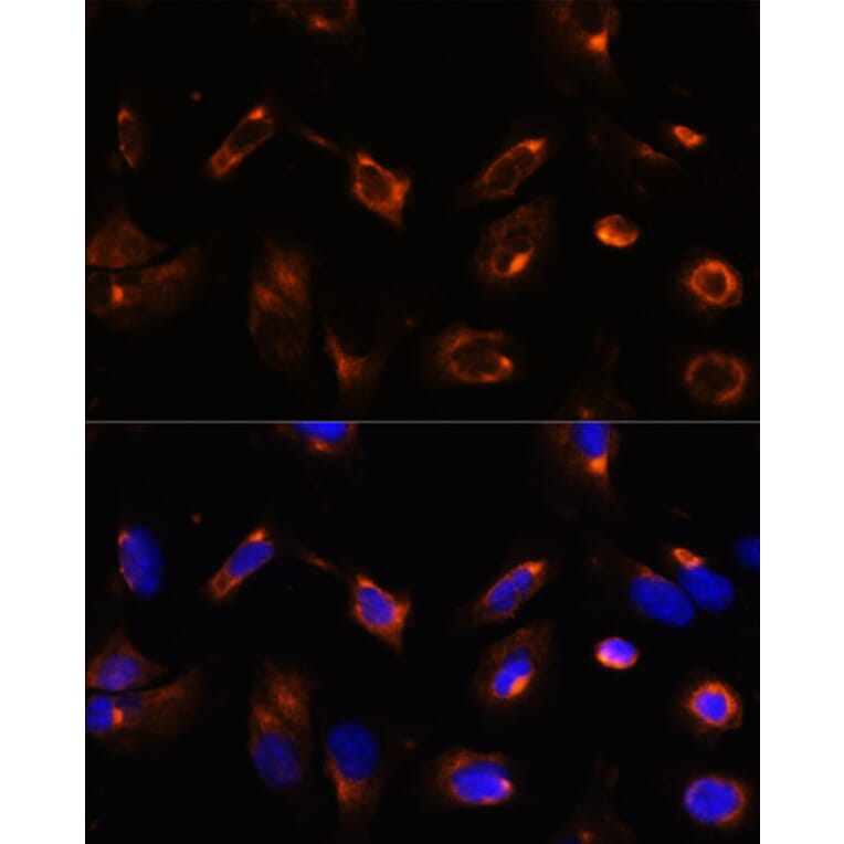 Immunofluorescence - Anti-LRRFIP2 Antibody (A93256) - Antibodies.com