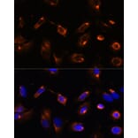 Immunofluorescence - Anti-LRRFIP2 Antibody (A93256) - Antibodies.com