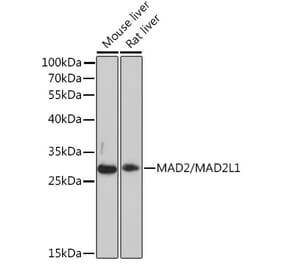 Western Blot - Anti-Mad2L1 Antibody (A93257) - Antibodies.com