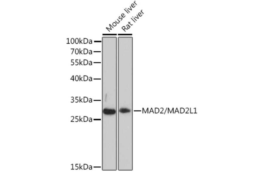 Western Blot - Anti-Mad2L1 Antibody (A93257) - Antibodies.com