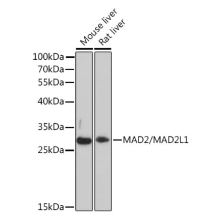 Western Blot - Anti-Mad2L1 Antibody (A93257) - Antibodies.com