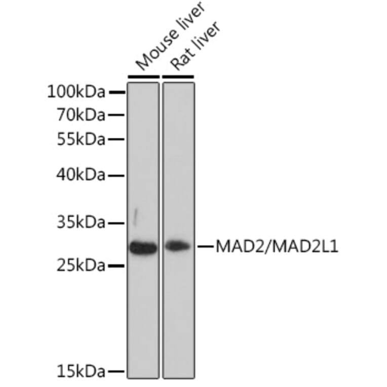 Western Blot - Anti-Mad2L1 Antibody (A93257) - Antibodies.com