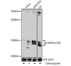 Western Blot - Anti-LC3B Antibody [AMC0036] (A93258) - Antibodies.com