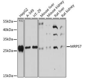 Western Blot - Anti-MRPS7 Antibody (A93261) - Antibodies.com