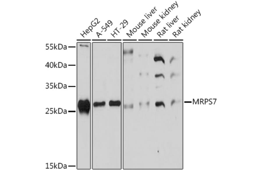 Western Blot - Anti-MRPS7 Antibody (A93261) - Antibodies.com