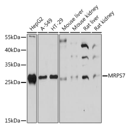 Western Blot - Anti-MRPS7 Antibody (A93261) - Antibodies.com