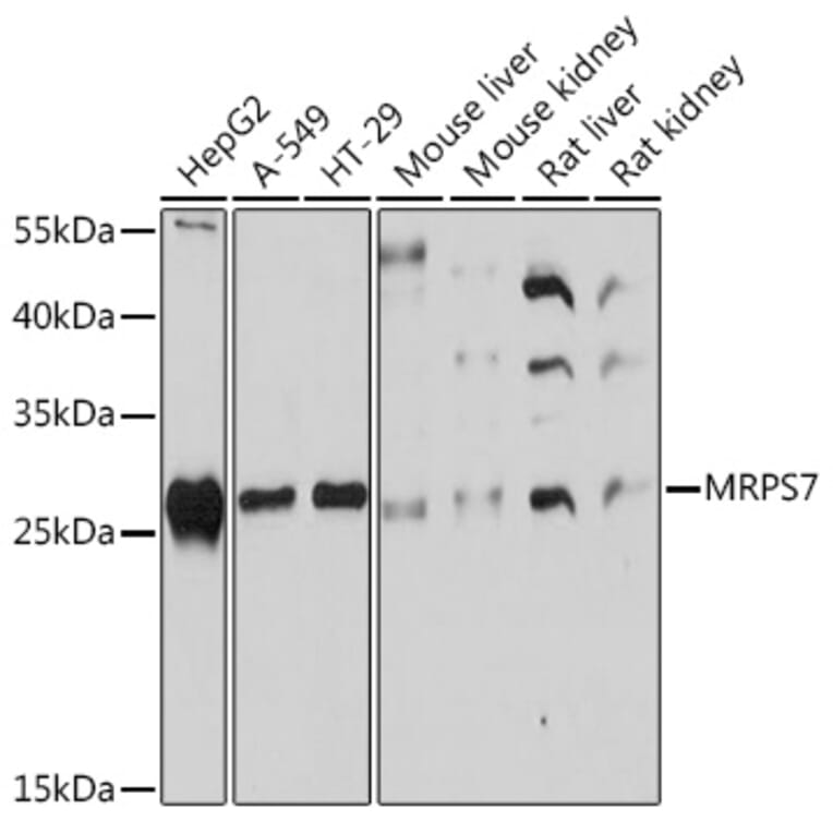 Western Blot - Anti-MRPS7 Antibody (A93261) - Antibodies.com