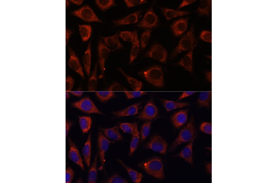 Immunofluorescence - Anti-MRPS7 Antibody (A93261) - Antibodies.com