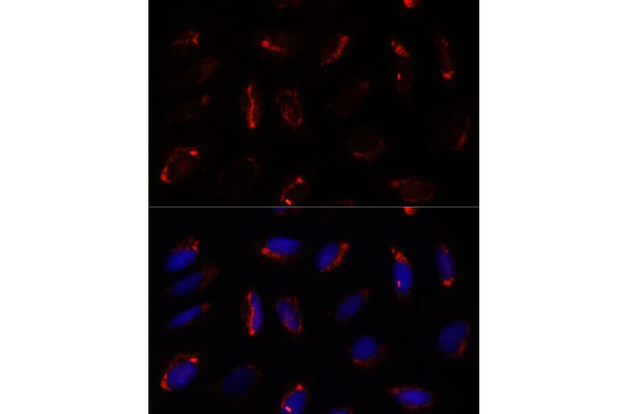 Immunofluorescence - Anti-MRPS7 Antibody (A93261) - Antibodies.com