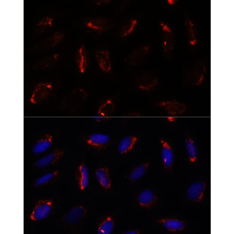 Immunofluorescence - Anti-MRPS7 Antibody (A93261) - Antibodies.com