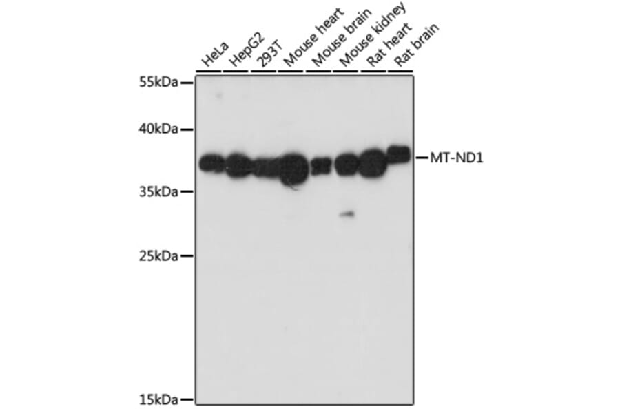 Western Blot - Anti-MT-ND1 Antibody (A93262) - Antibodies.com