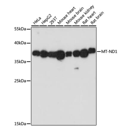 Western Blot - Anti-MT-ND1 Antibody (A93262) - Antibodies.com