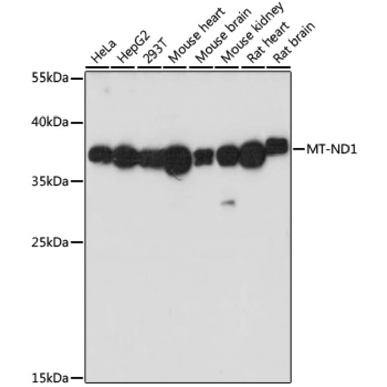 Western Blot - Anti-MT-ND1 Antibody (A93262) - Antibodies.com