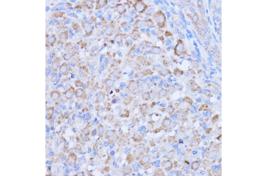 Immunohistochemistry - Anti-MT-ND1 Antibody (A93262) - Antibodies.com