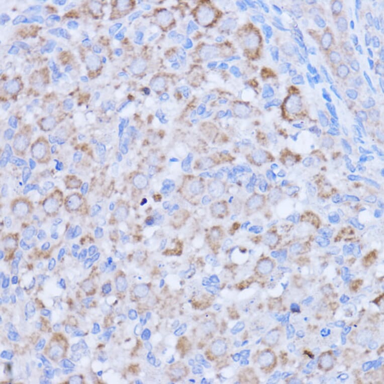 Immunohistochemistry - Anti-MT-ND1 Antibody (A93262) - Antibodies.com