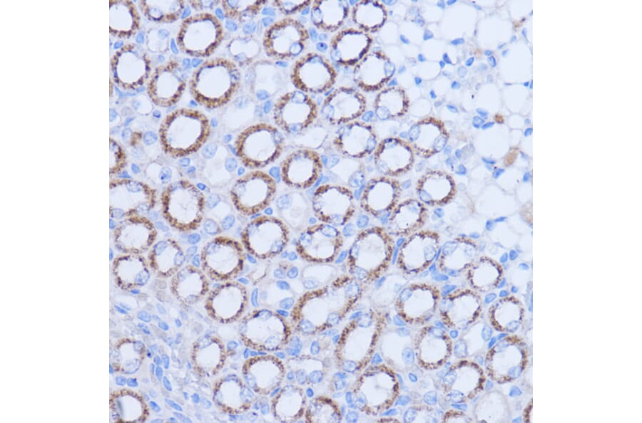 Immunohistochemistry - Anti-MT-ND1 Antibody (A93262) - Antibodies.com