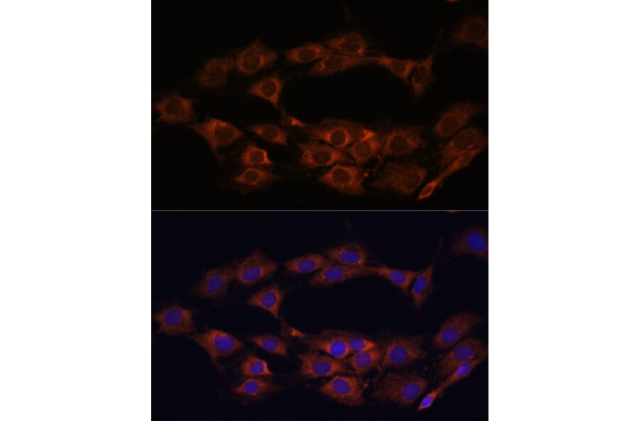 Immunofluorescence - Anti-MT-ND1 Antibody (A93262) - Antibodies.com