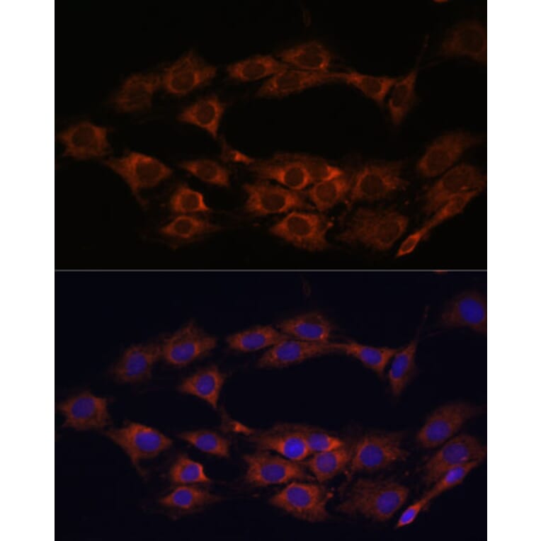 Immunofluorescence - Anti-MT-ND1 Antibody (A93262) - Antibodies.com