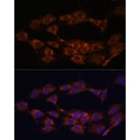 Immunofluorescence - Anti-MT-ND1 Antibody (A93262) - Antibodies.com