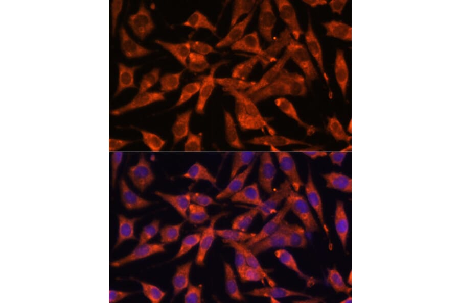 Immunofluorescence - Anti-MT-ND1 Antibody (A93262) - Antibodies.com