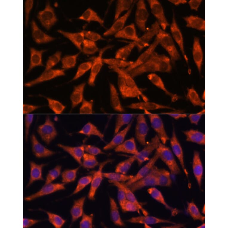 Immunofluorescence - Anti-MT-ND1 Antibody (A93262) - Antibodies.com