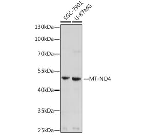 Western Blot - Anti-ND4 Antibody (A93263) - Antibodies.com