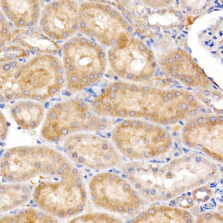 Immunohistochemistry - Anti-ND4 Antibody (A93263) - Antibodies.com