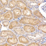Immunohistochemistry - Anti-ND4 Antibody (A93263) - Antibodies.com