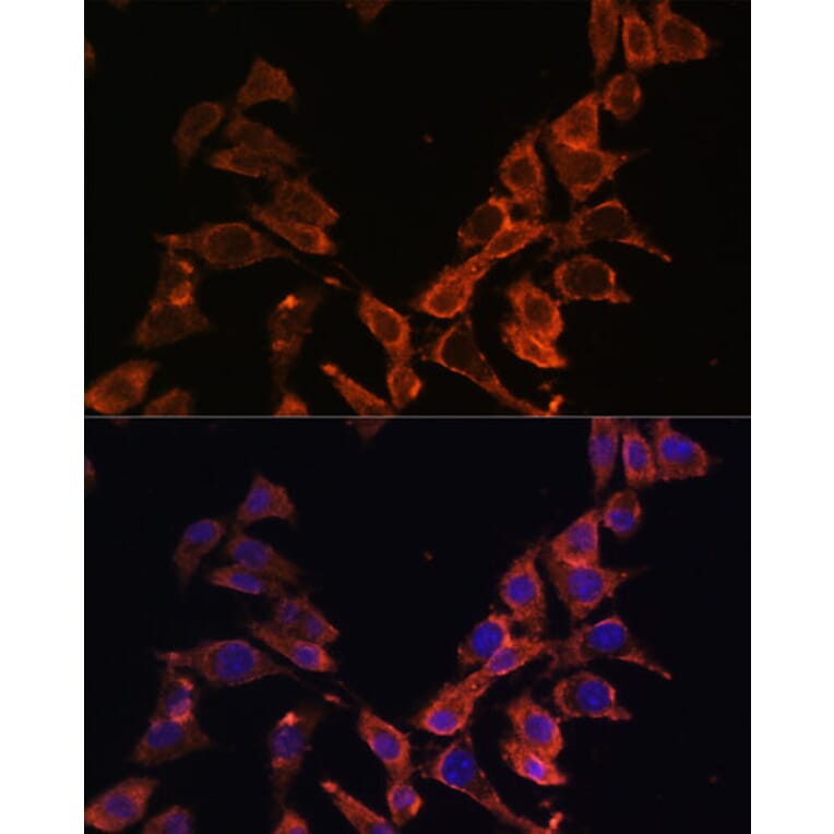 Immunofluorescence - Anti-ND4 Antibody (A93263) - Antibodies.com