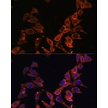Immunofluorescence - Anti-ND4 Antibody (A93263) - Antibodies.com
