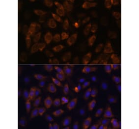 Immunofluorescence - Anti-MT-ND4L Antibody (A93264) - Antibodies.com