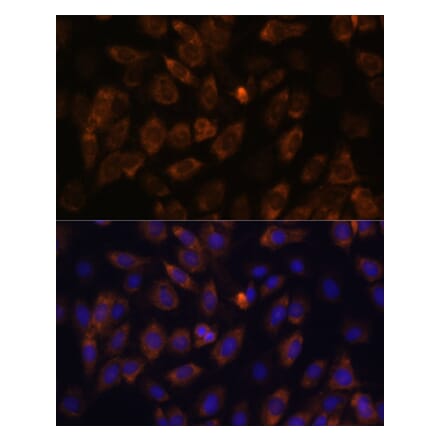 Immunofluorescence - Anti-MT-ND4L Antibody (A93264) - Antibodies.com