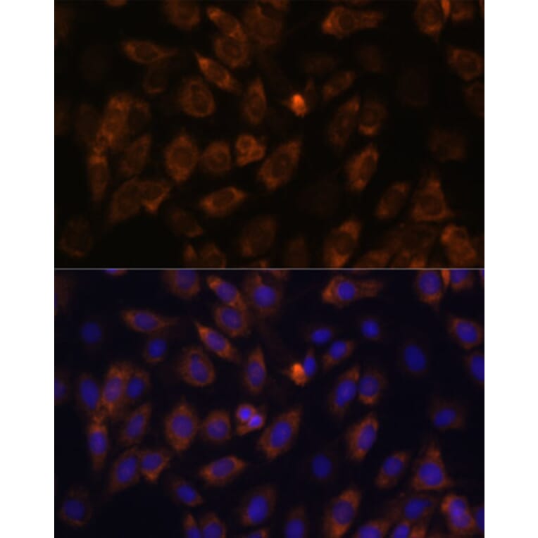Immunofluorescence - Anti-MT-ND4L Antibody (A93264) - Antibodies.com