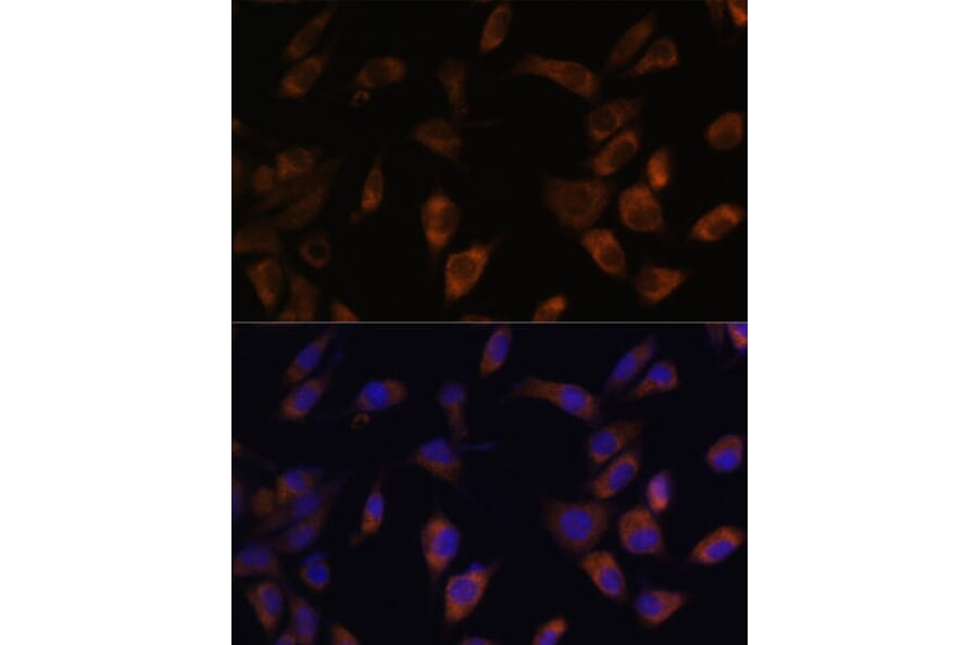 Immunofluorescence - Anti-MT-ND4L Antibody (A93264) - Antibodies.com