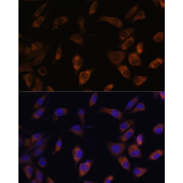 Immunofluorescence - Anti-MT-ND4L Antibody (A93264) - Antibodies.com
