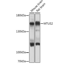 Western Blot - Anti-TIP150 Antibody (A93265) - Antibodies.com