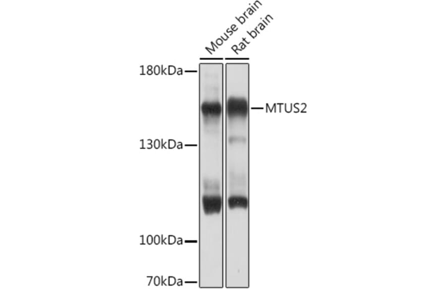 Western Blot - Anti-TIP150 Antibody (A93265) - Antibodies.com