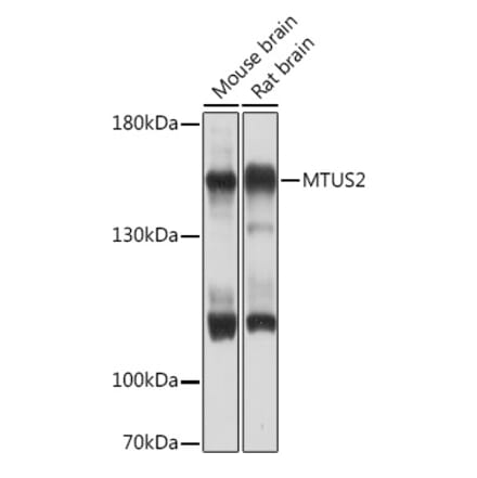 Western Blot - Anti-TIP150 Antibody (A93265) - Antibodies.com