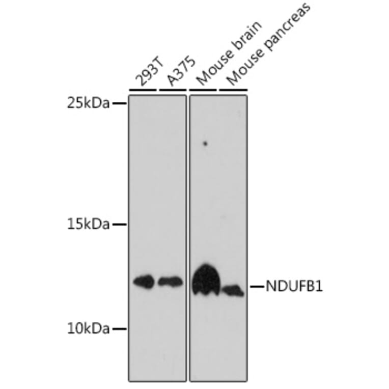 Western Blot - Anti-NDUFB1 Antibody (A93267) - Antibodies.com