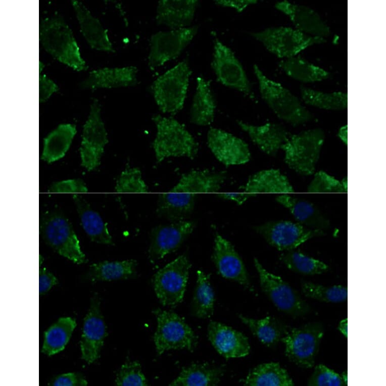 Immunofluorescence - Anti-NDUFB1 Antibody (A93267) - Antibodies.com