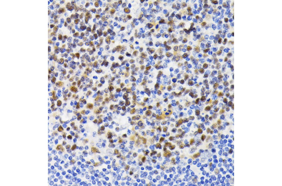Immunohistochemistry - Anti-NFAT2 Antibody (A93268) - Antibodies.com