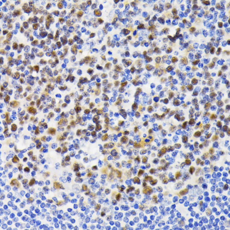 Immunohistochemistry - Anti-NFAT2 Antibody (A93268) - Antibodies.com
