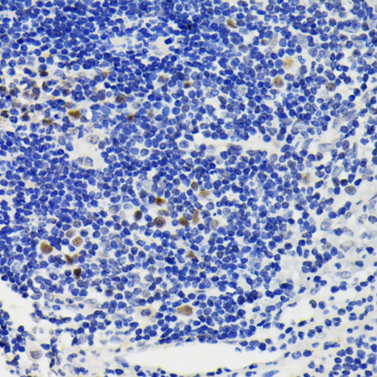Immunohistochemistry - Anti-NFAT2 Antibody (A93268) - Antibodies.com