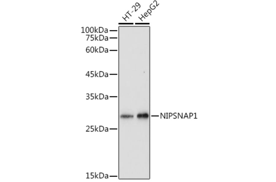 Western Blot - Anti-NIPSNAP1 Antibody (A93270) - Antibodies.com