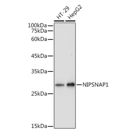 Western Blot - Anti-NIPSNAP1 Antibody (A93270) - Antibodies.com