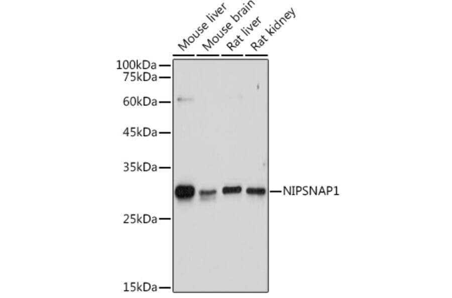 Western Blot - Anti-NIPSNAP1 Antibody (A93270) - Antibodies.com