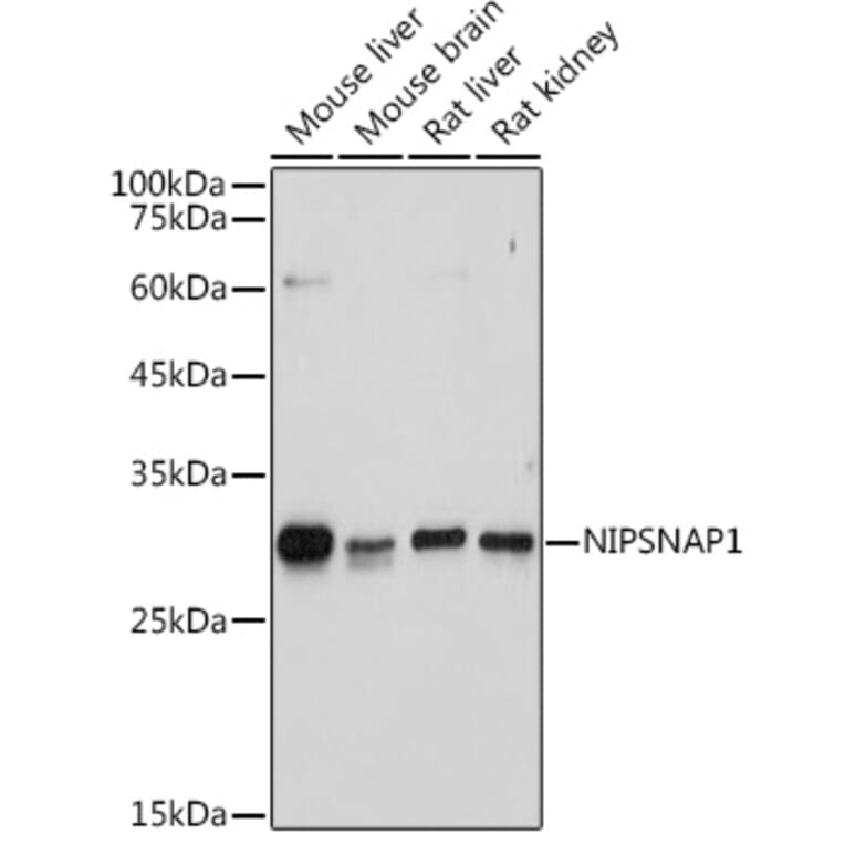 Western Blot - Anti-NIPSNAP1 Antibody (A93270) - Antibodies.com