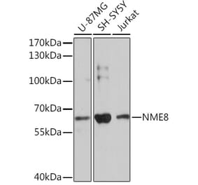 Western Blot - Anti-NME8 Antibody (A93271) - Antibodies.com